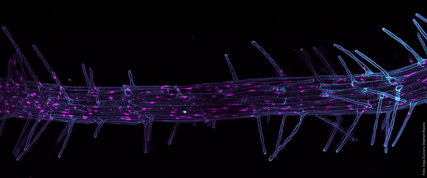 Mikroskopaufnahme gefärbte Pflanzenwurzel
